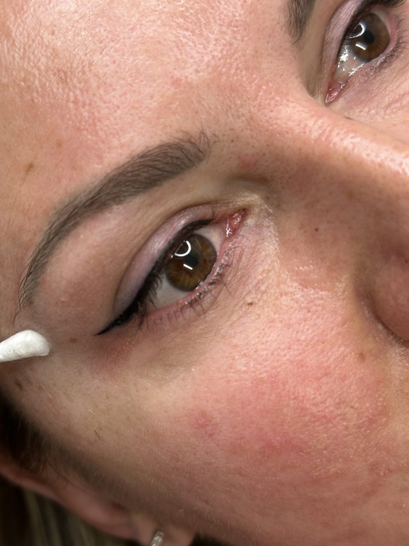 Healed permanent eyeliner, close up