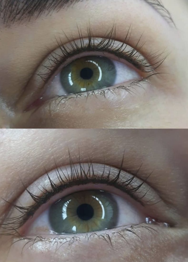 Healed permanent eyeliner