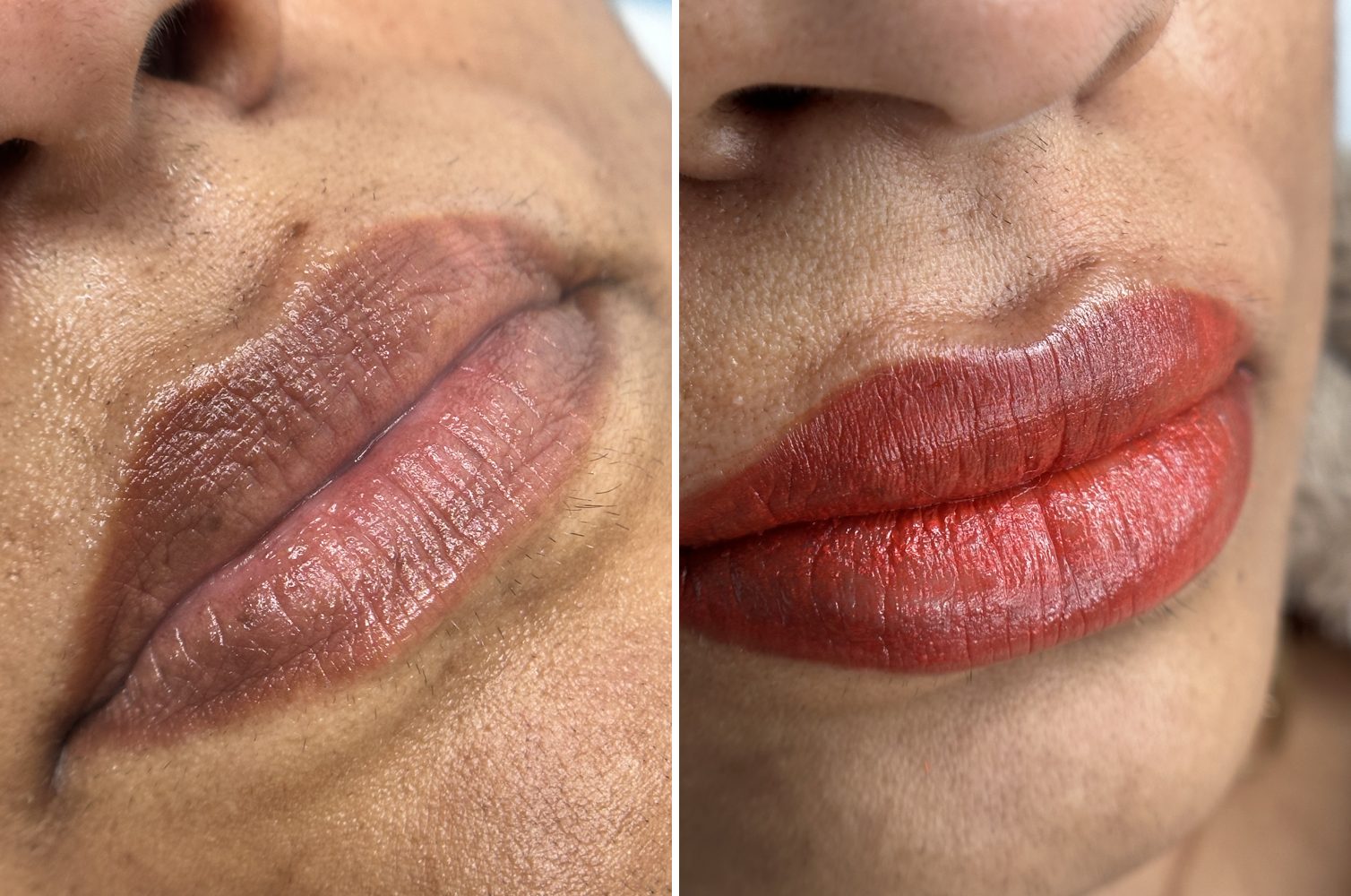 Before and after lip blush
