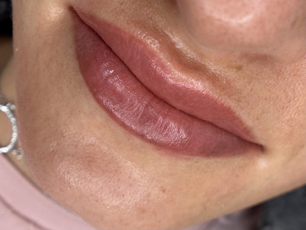 Dark lip neutralisation result
